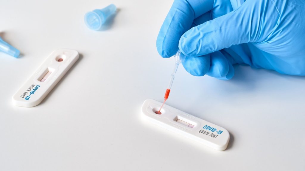 A professional handles an antigen COVID test